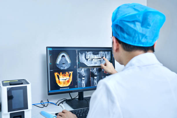 Best Knocked-Out Tooth (Avulsed Tooth) Treatment in St Ignace, MI