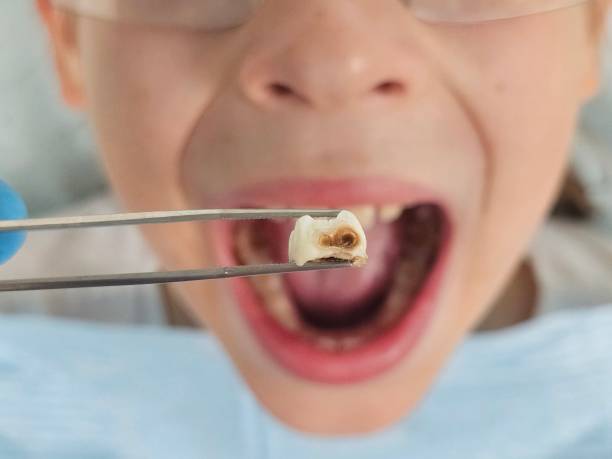 Best Emergency Treatment for Jaw Pain or Injury in St Ignace, MI